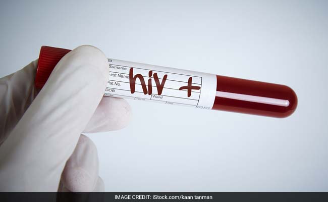 10-Year Lifespan Gain For Some HIV Patients: Study