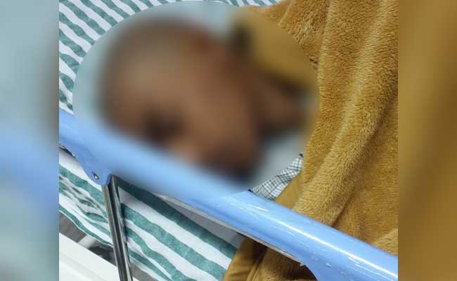 Hyderabad Student Hit With Duster By Teacher Goes Through Brain Surgery