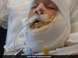 Bullied 10-Year-Old With Special Needs Was Set On Fire By Another Child, Family Says Bullied 10-Year-Old With Special Needs Was Set On Fire By Another Child, Family Says