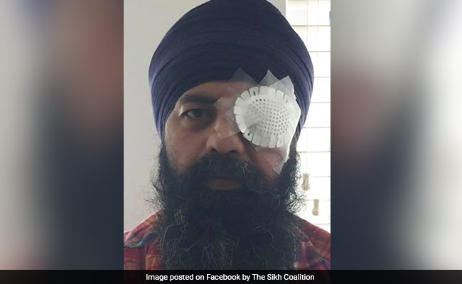 Sikh Techie Beaten, Hair Cut With Knife In Alleged Hate Crime In US