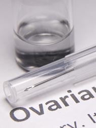 6 Facts You Should Know About Ovarian Cysts