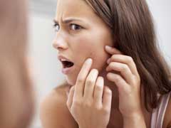 Acne Sufferers May Age Slowly, Say Study