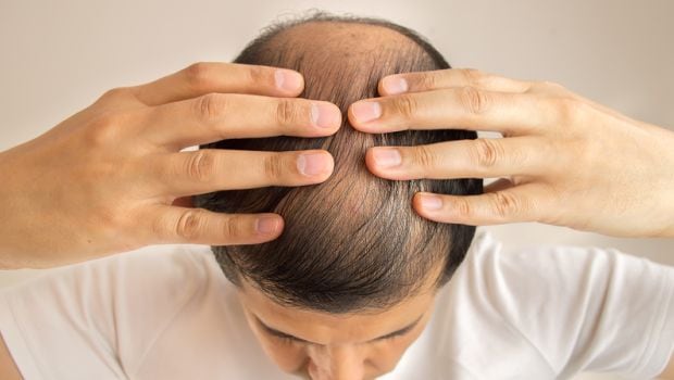 Baldness And Hairfall Problem: जमालगोट्यामुळे टक्कल जाऊन केसांची भराभर होते वाढ? फॅक्ट चेकमधून उघड झाले सत्य Baldness And Hairfall Problem: जमालगोट्यामुळे टक्कल जाऊन केसांची भराभर होते वाढ? फॅक्ट चेकमधून उघड झाले सत्य