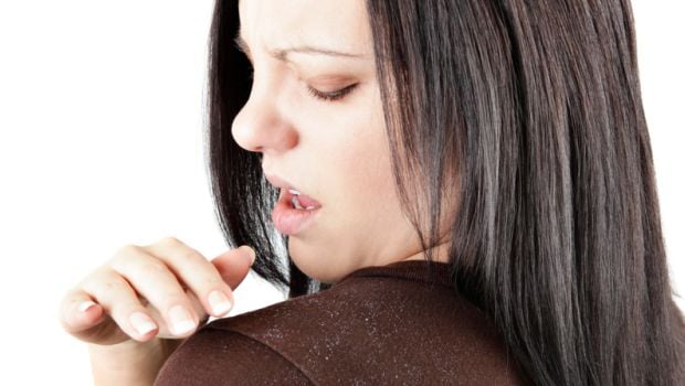Types of Dandruff: Things to Keep in Mind Before Buying an Anti-Dandruff Product