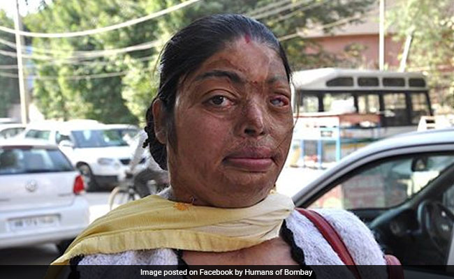 How Mumbai Woman Reclaimed Her Life After Acid Attack Is Beyond Inspiring