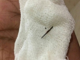 Needle Removed From Man's Body In Kerala After 22 Years Needle Removed From Man's Body In Kerala After 22 Years