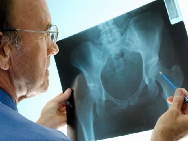 ऑस्टियोपोरोसिस को अनदेखा न करें, जानें इसके इलाज के बारे में...