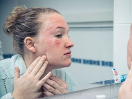 बार-बार होती है Skin Allergy तो जरूर अपनाएं ये घरेलू उपाय बार-बार होती है Skin Allergy तो जरूर अपनाएं ये घरेलू उपाय