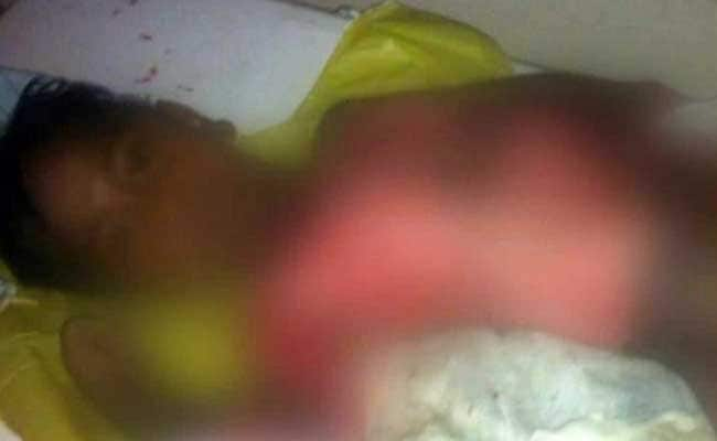 6-Year-Old Falls Into Boiling Sambar During Midday Meal In Telangana, Dies