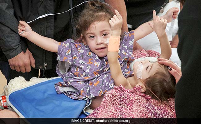 Separated Conjoined Twins Meet For First Time Since Surgery