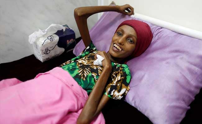 Emaciated 18-Year-Old Yemeni Girl Now Smiles But Recovery Patchy
