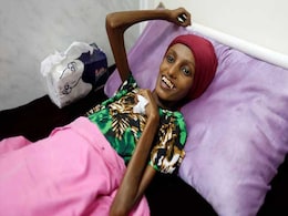 Emaciated 18-Year-Old Yemeni Girl Now Smiles But Recovery Patchy Emaciated 18-Year-Old Yemeni Girl Now Smiles But Recovery Patchy