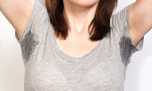 Hyperhidrosis: Top Treatments For Excessive Sweat You Must Know
