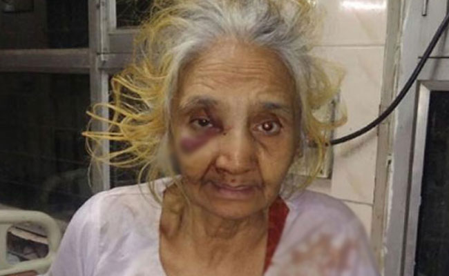 70-Year-Old Woman Brutally Thrashed By Son In New Delhi