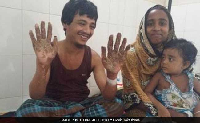 Bangladesh Tree Man Sees Hope After 16 Surgeries जल्द ही ठीक होकर घर 