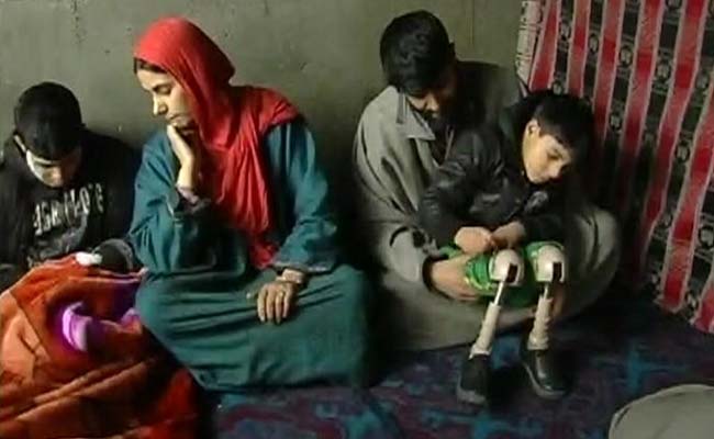 Kashmir Schools Turn Away 6-Year-Old Disabled By Mortar