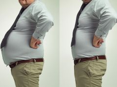 Fat Shaming Can Be Major Cause of Health Disorders