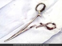 Scissors Pulled From Man's Stomach 18 Years After Surgery Scissors Pulled From Man's Stomach 18 Years After Surgery