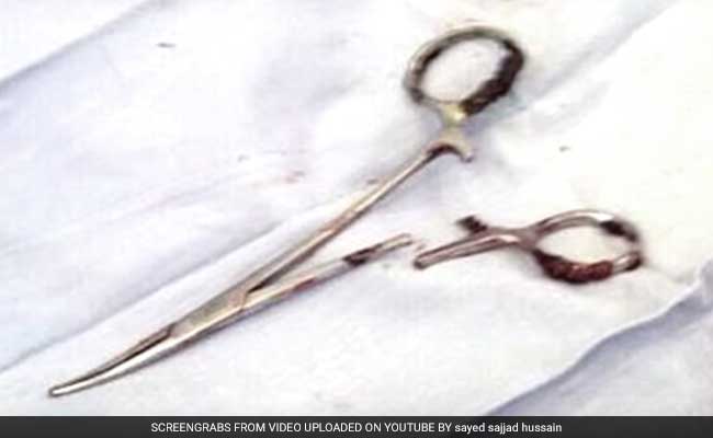 Scissors Pulled From Man's Stomach 18 Years After Surgery