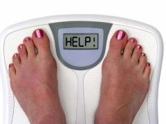 Obesity May Put Women at the Risk of Developing Rheumatoid Arthritis