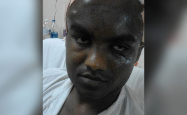 थाने से सबूत गायब, मुंबई पुलिस ने पीड़ित से मांगी खून लगी हुई दूसरी शर्ट!