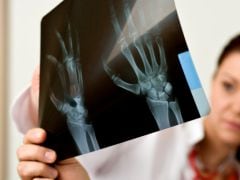 What Is Lupus? What Is Lupus?