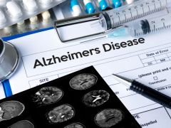 This May Be the Reason Why Alzheimer's Patients Lose their Memory