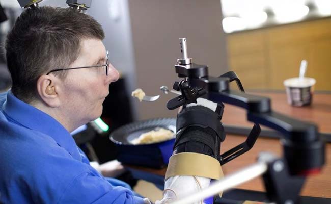 New Technology Allows Paralyzed Man To Move Arm By Thinking About It