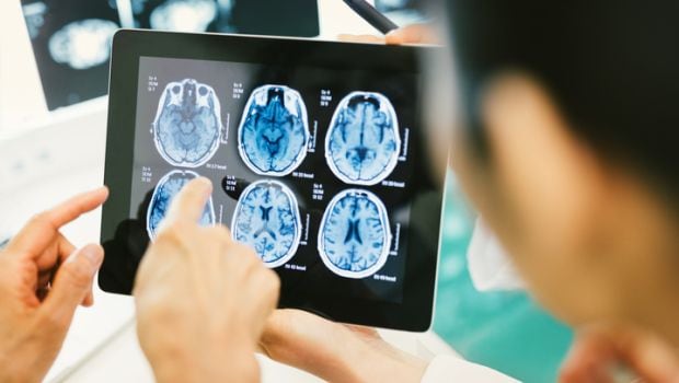 3-D Mini Brains May Help Experts Study Rare Brain Disorders