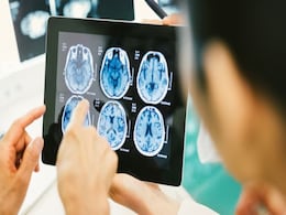 Brain Tumor: All About The Different Treatment Options For This Condition Brain Tumor: All About The Different Treatment Options For This Condition