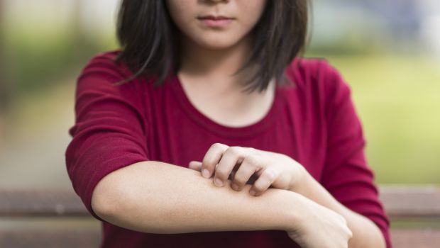 Psoriasis Vs Eczema: अलग-अलग हैं एग्जिमा और सोरायसिस, जानें क्या है फर्क