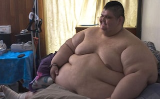 Obesity: World's Heaviest Man to Undergo Gastric Bypass Surgery