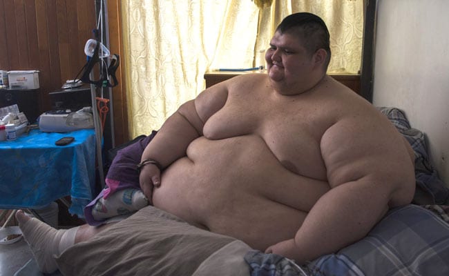 World's Most Obese Man, 32, Has Been On 3-Month Diet For Surgery: Report