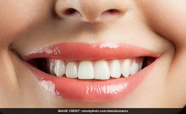 Are You Taking Care Of Your Teeth?