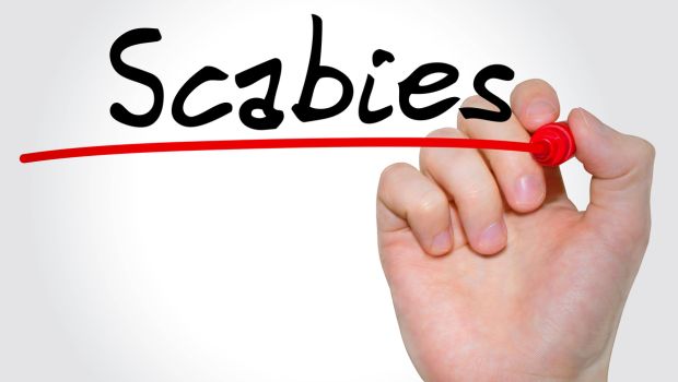 7 Most Effective Home Remedies for Scabies