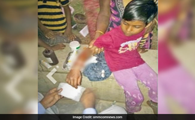 Odisha 6-Year-Old Hit Crocodile On Head To Save Classmate