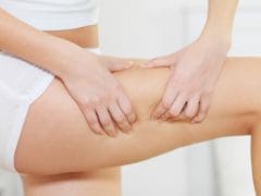 9 Effective Ways To Get Rid Of Cellulite Ndtv Food