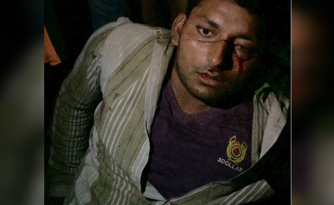 Cattle Trade Too Risky, Want Sons Out, Says Father Of Man Beaten in Delhi