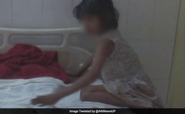 The Girl Who Doctors Believe Was Raised By Monkeys In Uttar Pradesh