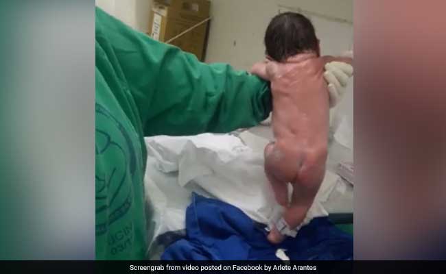 Baby 'Walks' Moments After Birth. 68 Million Views And Counting