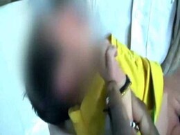 Rat Bites Infant At Hospital In Madhya Pradesh Rat Bites Infant At Hospital In Madhya Pradesh