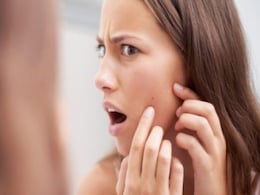 How To Get Rid Of Pimples: पूजा मखीजा से जानें टीनएज एक्ने से छुटकारा पाने के लिए बेहतरीन न्यूट्रिशनल हैक्स How To Get Rid Of Pimples: पूजा मखीजा से जानें टीनएज एक्ने से छुटकारा पाने के लिए बेहतरीन न्यूट्रिशनल हैक्स