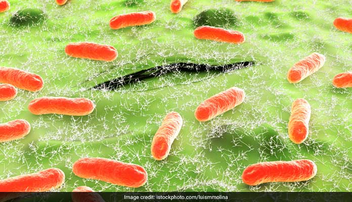 Anthrax Spreads In Vizag, Animal Products Likey Source