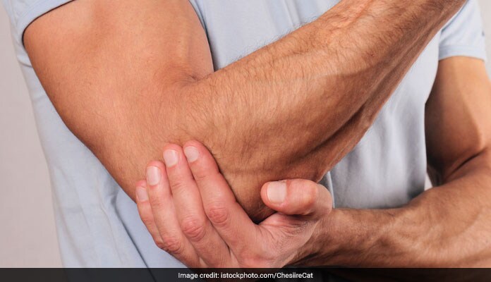 Arthritis leads to stiff painful joints