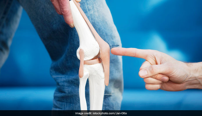 Osteoarthritis Treatment: नई कोशिका थैरेपी करेगी सूजन को कम और कार्टिलेज को फिर से विकसित...