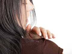 Dandruff? Try These Most Effective Natural Remedies