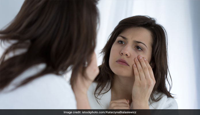 Get Rid Of Dark Circles With These Remedies
