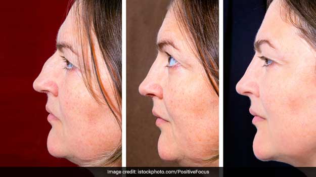 Get Rid Of Double Chin: Facial Yoga To Lose That Extra Facial Chub