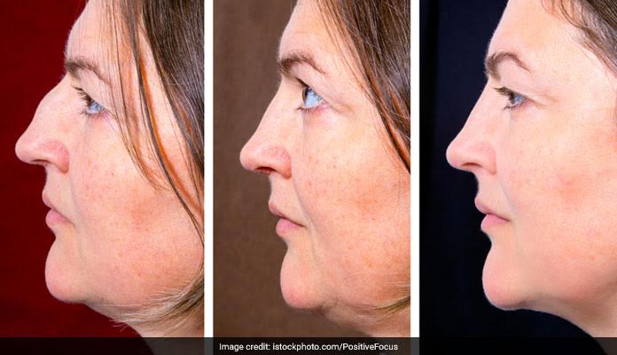 This Is How You Can Get Rid Of Your Double Chin!