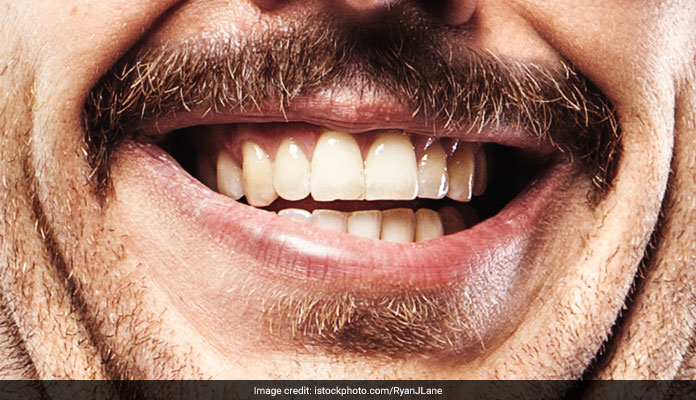 Get Rid Of Double Chin By Doing These 5 Easy Exercises, Soon The Face Will Be Seen In Shape